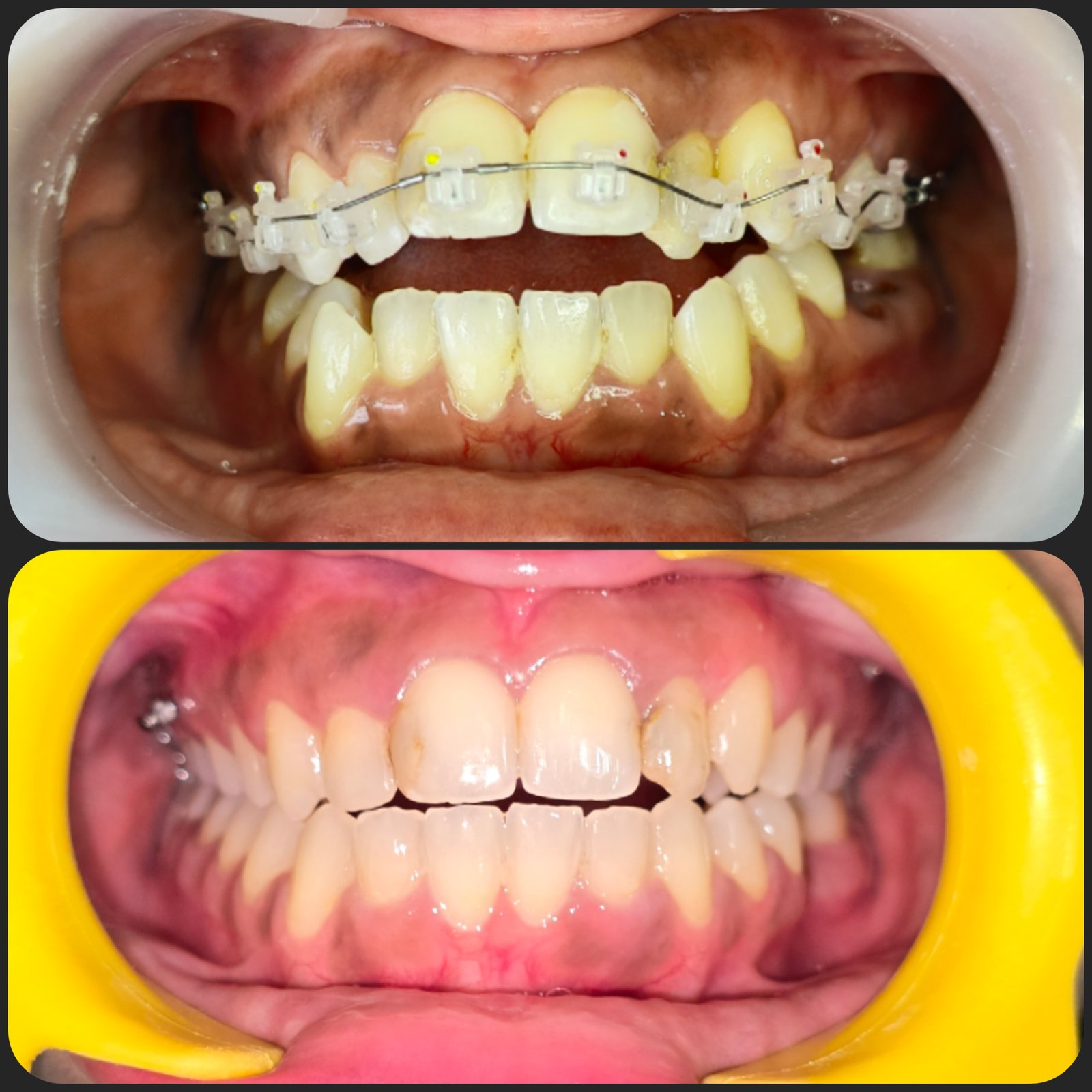 Smile transformation 23